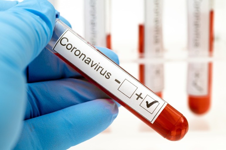 O’qituvchilar koronavirusga bepul test topshirib dorilar bilan ta’minlanmoqda