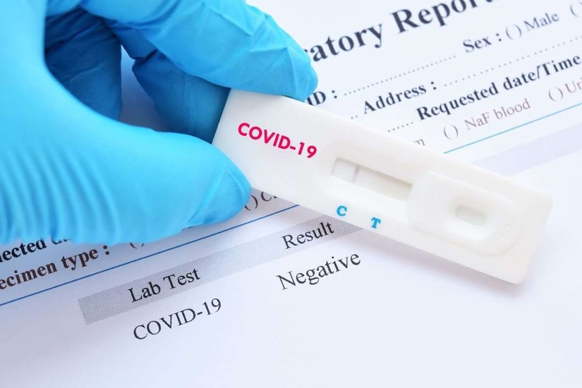 Koronavirusga test oladigan nodavlat tibbiy muassasalari ro‘yxati